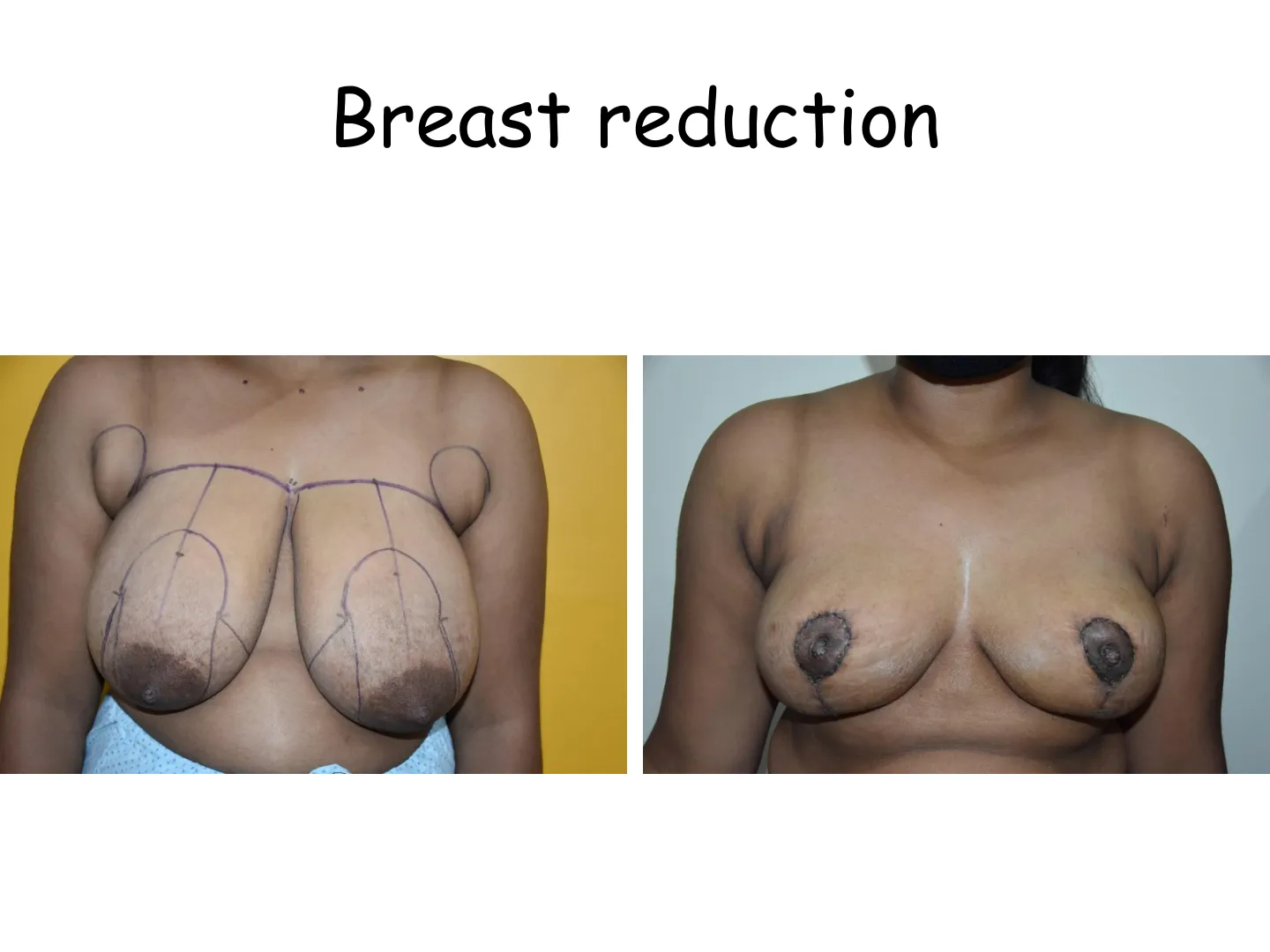 Transformation