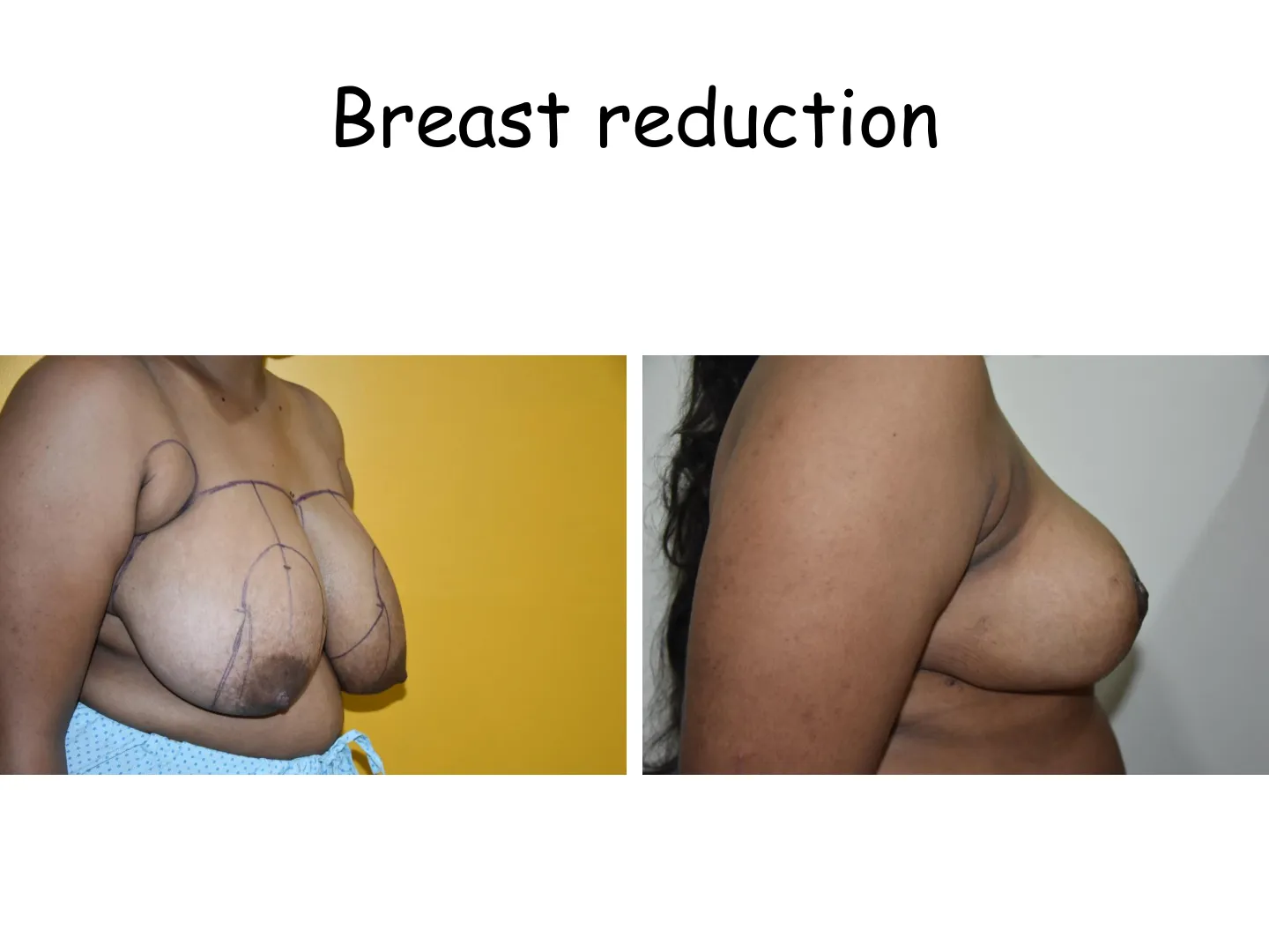 Transformation