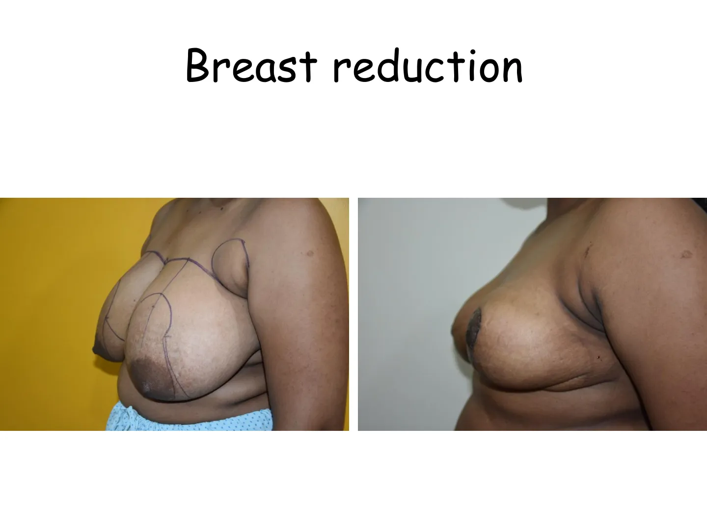 Transformation