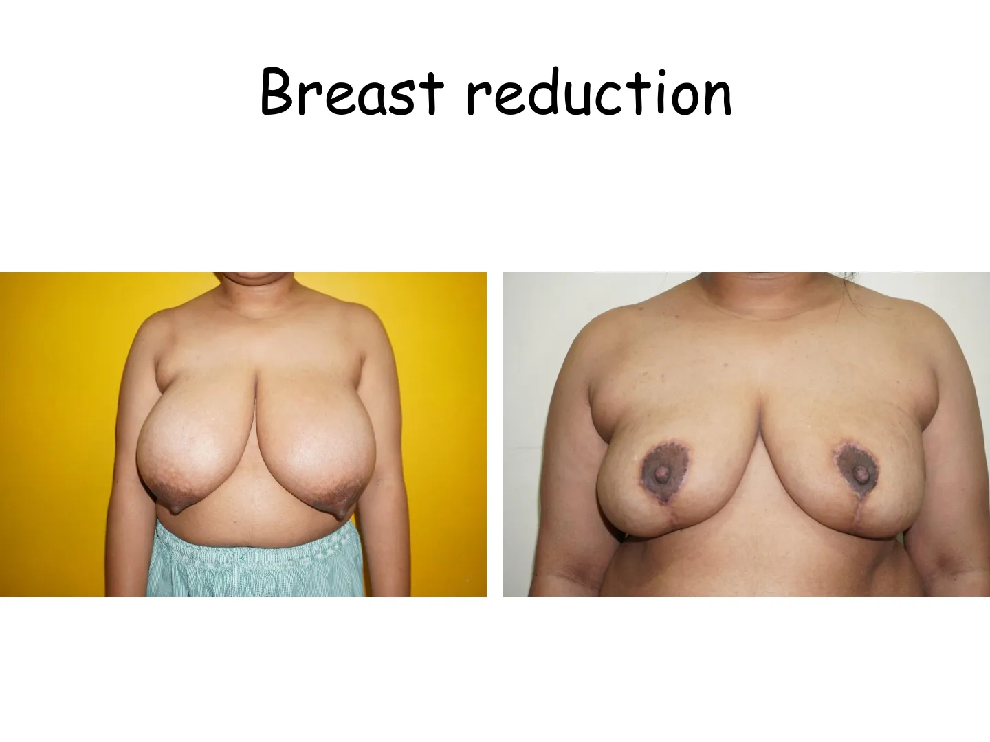 Transformation