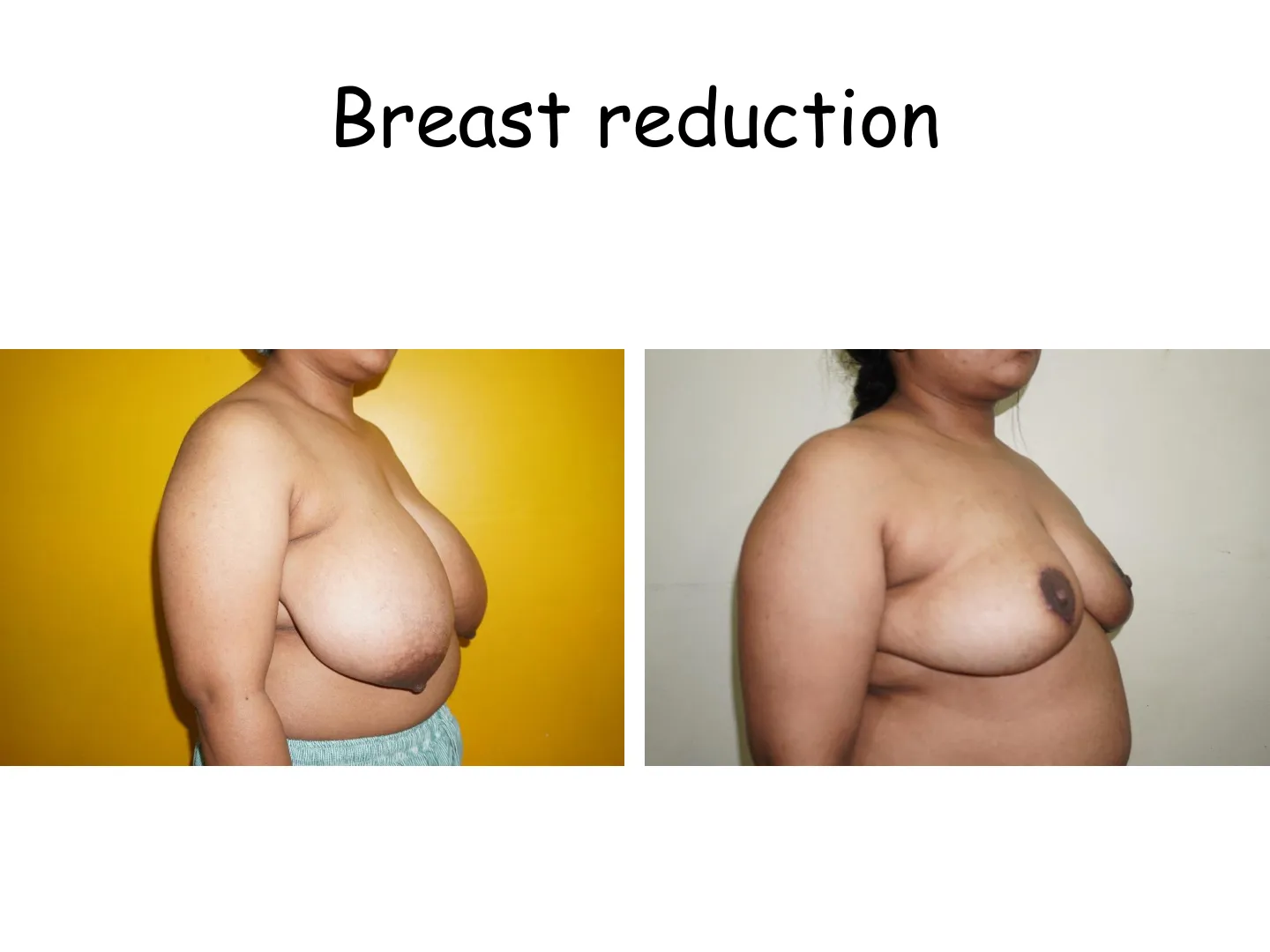 Transformation
