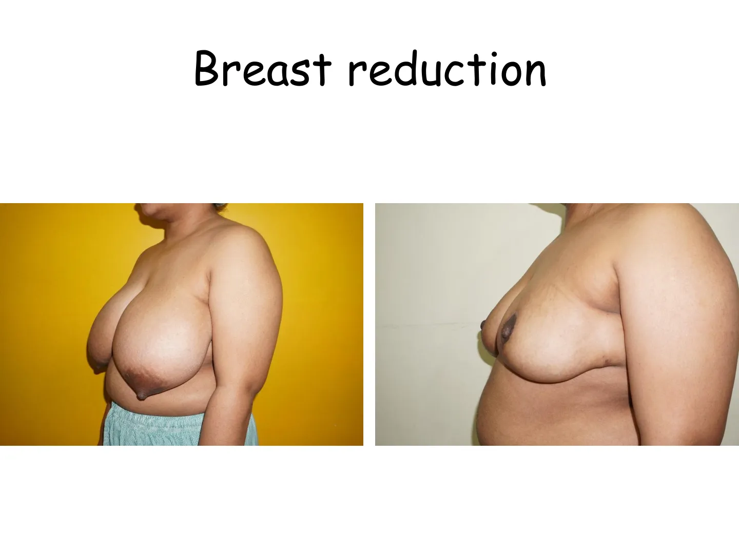 Transformation