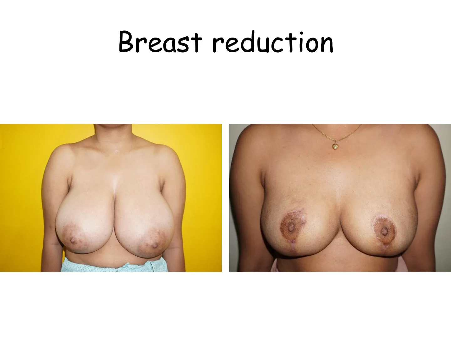 Transformation