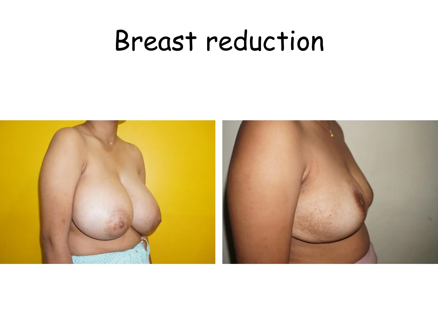 Transformation