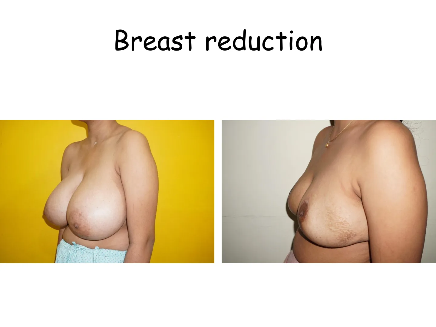 Transformation