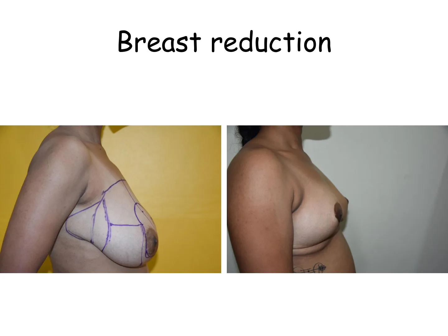 Transformation