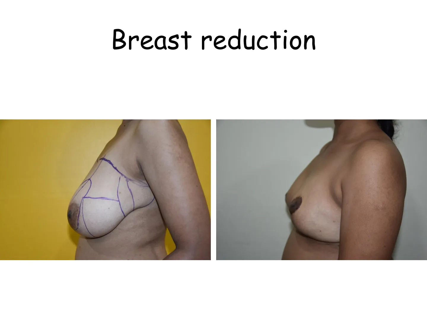 Transformation