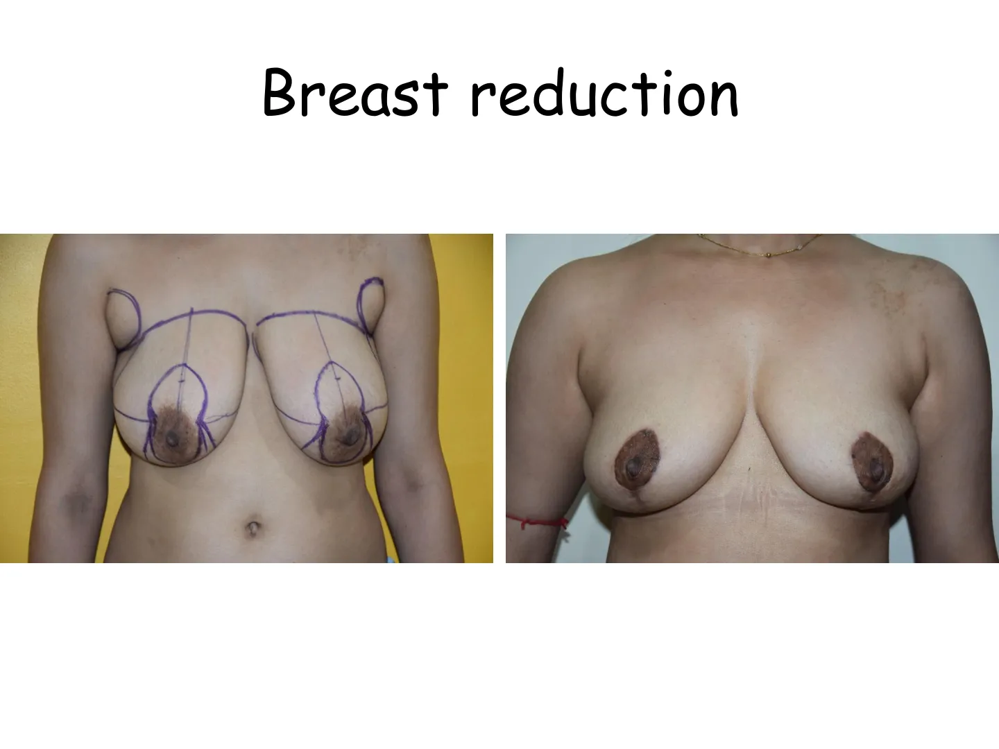 Transformation