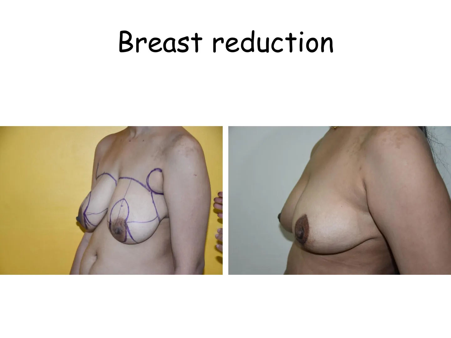 Transformation