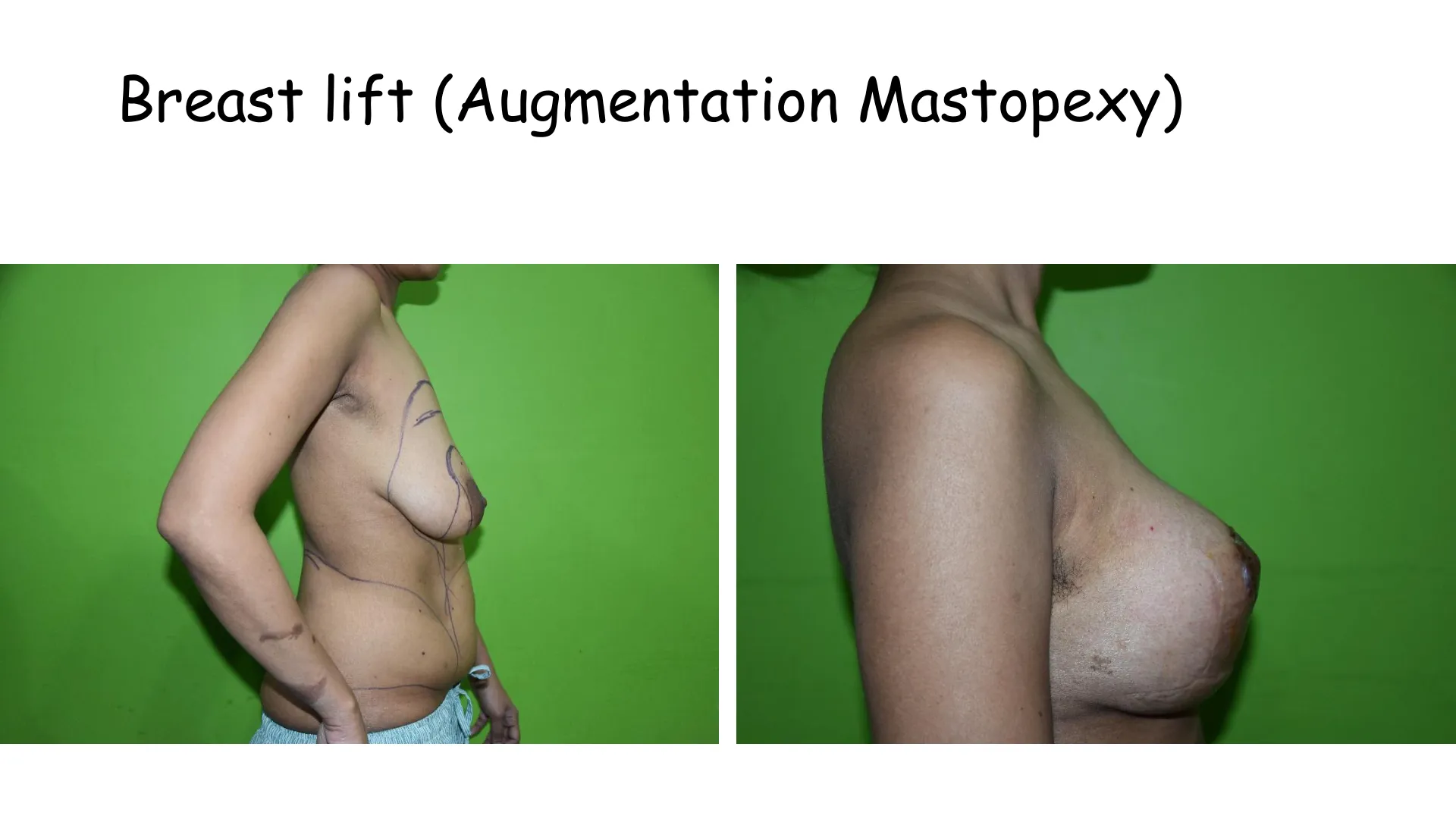 Transformation