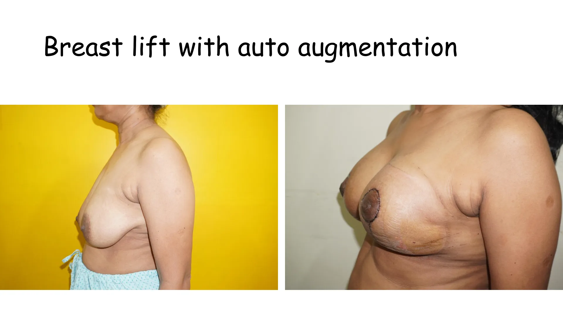 Transformation