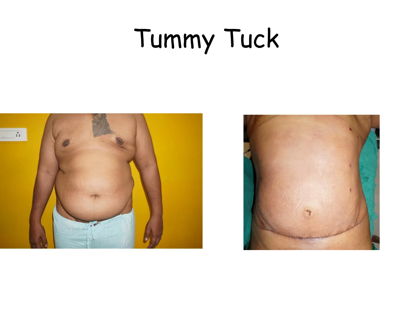 Transformation