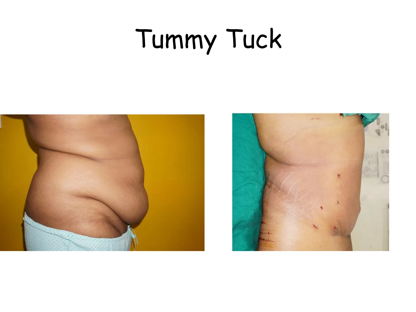 Transformation