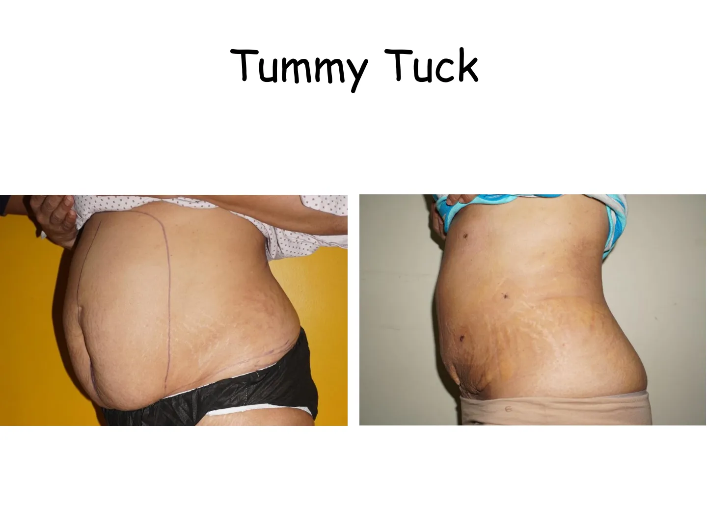 Transformation