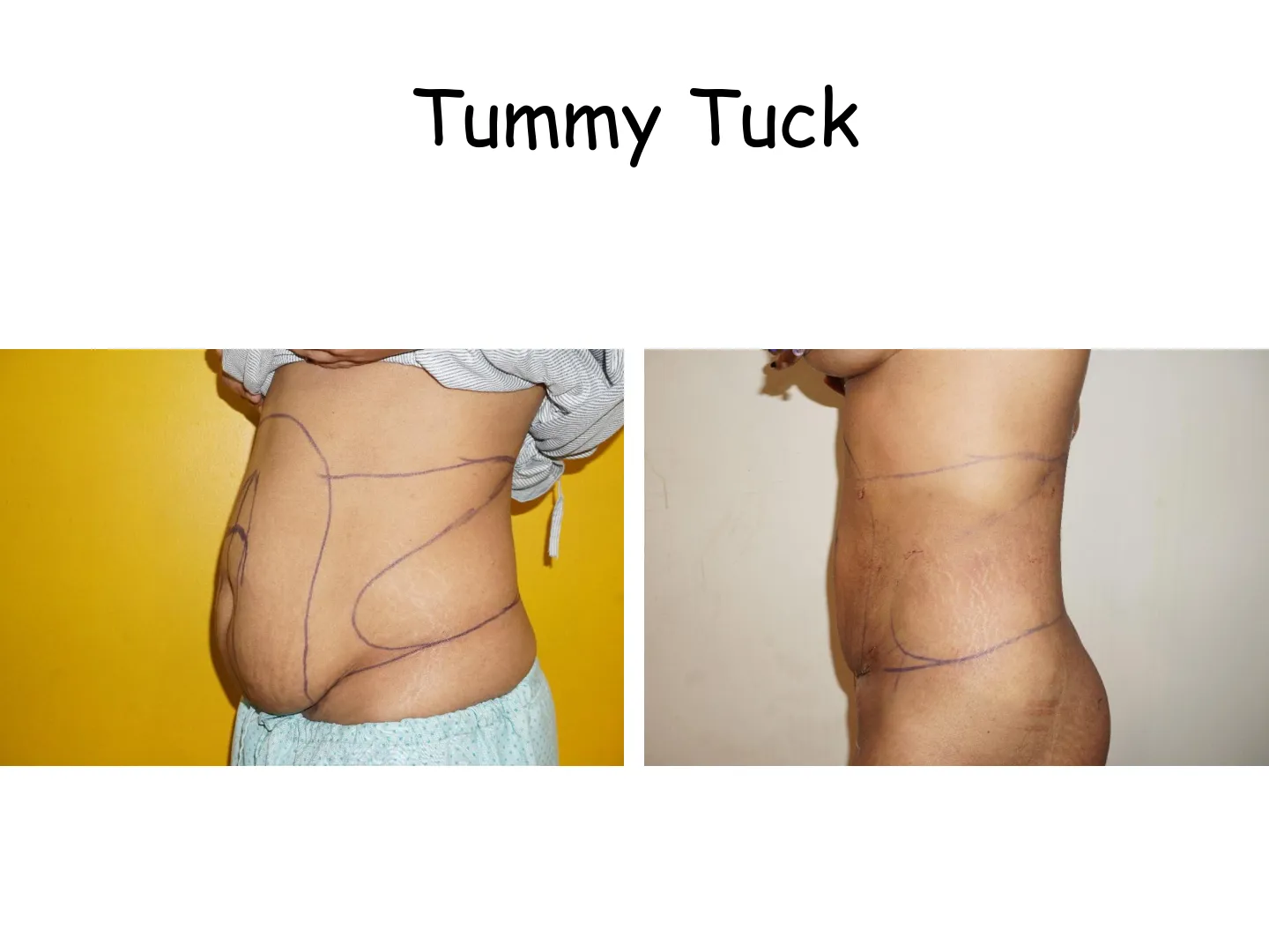 Transformation