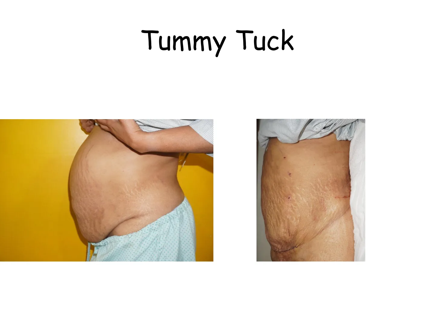 Transformation