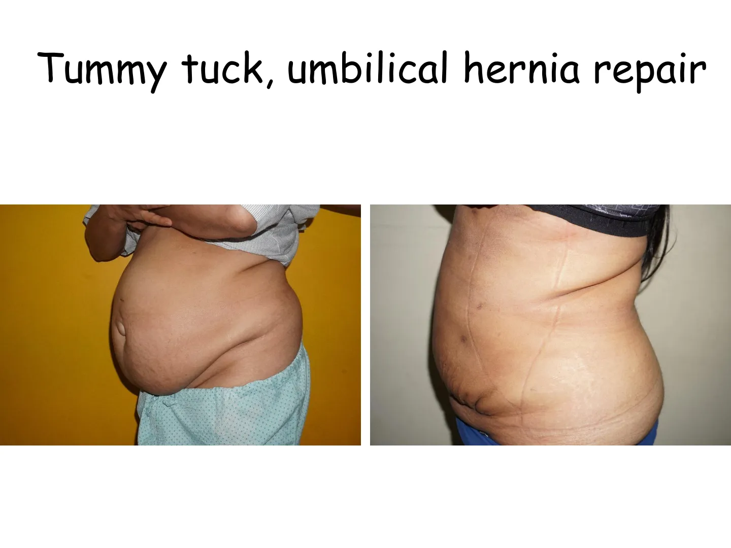 Transformation