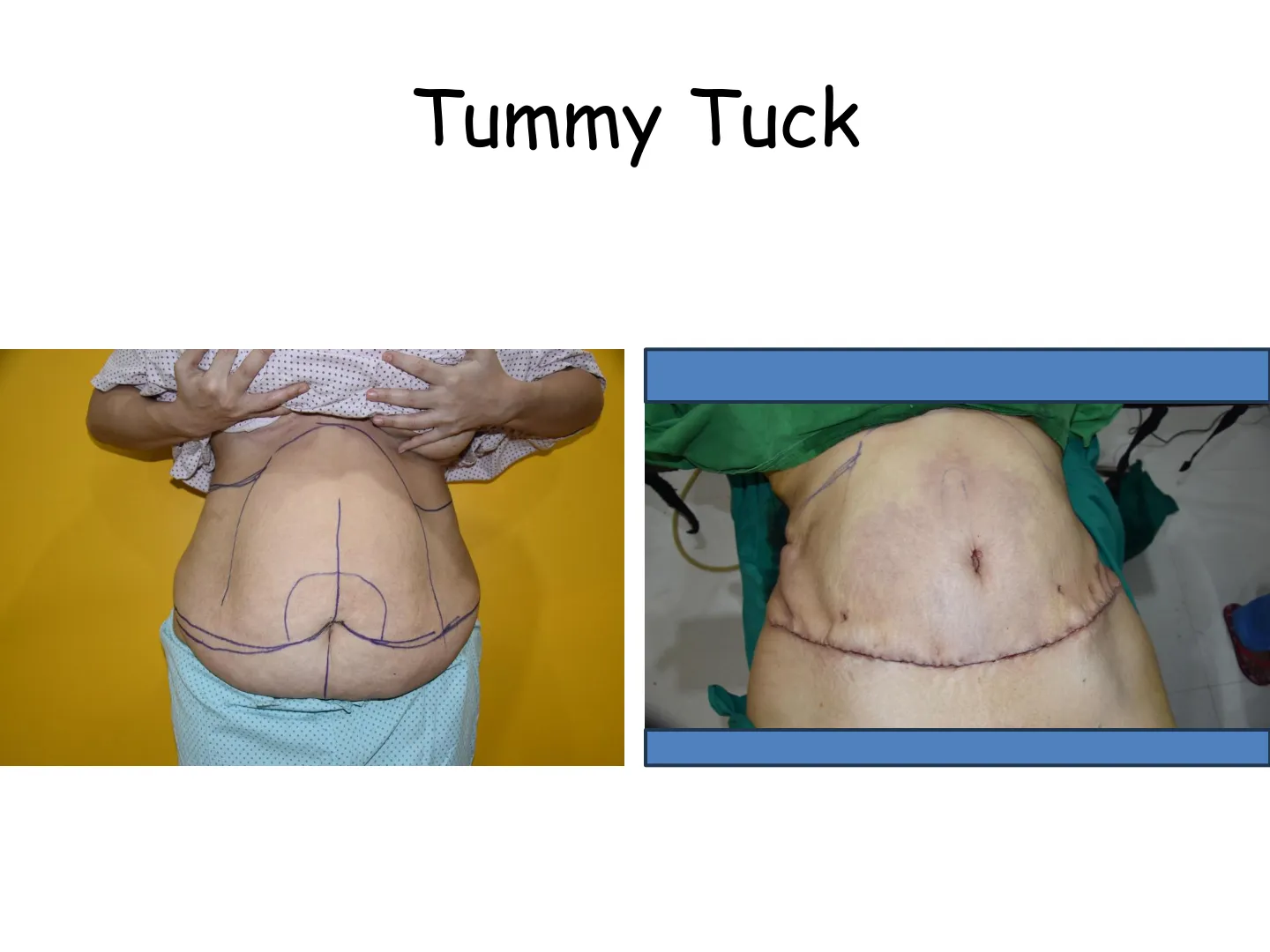 Transformation