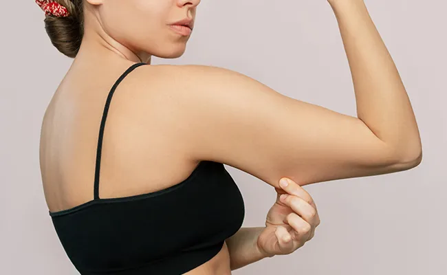 Arm Liposuction Surgery