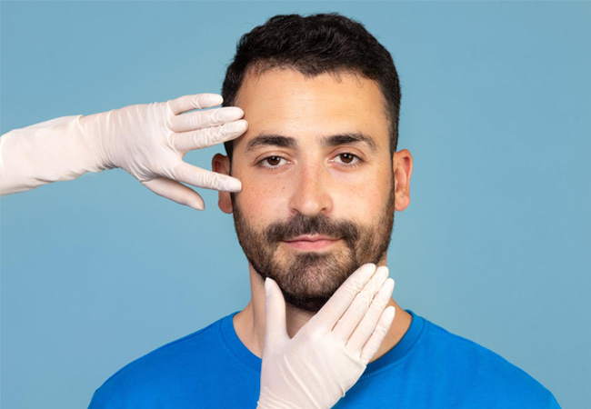 What is Beard Transplant Surgery?