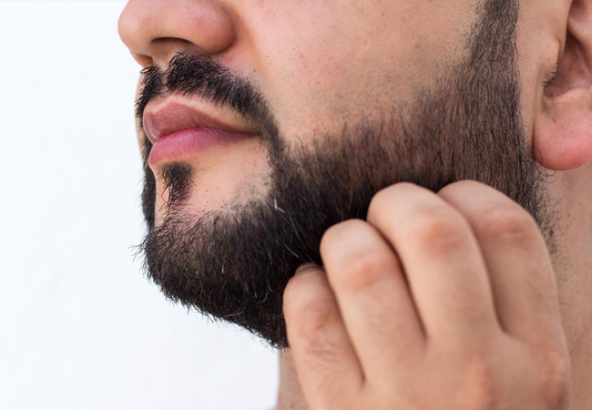Recovery After Beard Transplantation