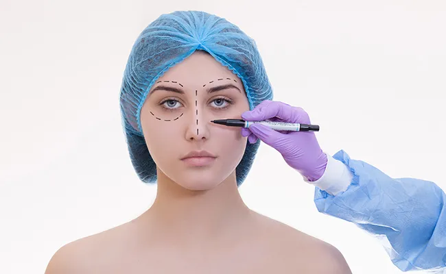 Eyelid Surgery Candidate