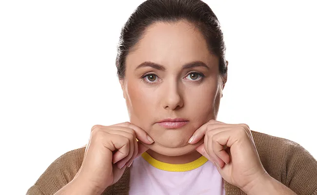 Buccal Fat Removal Surgery