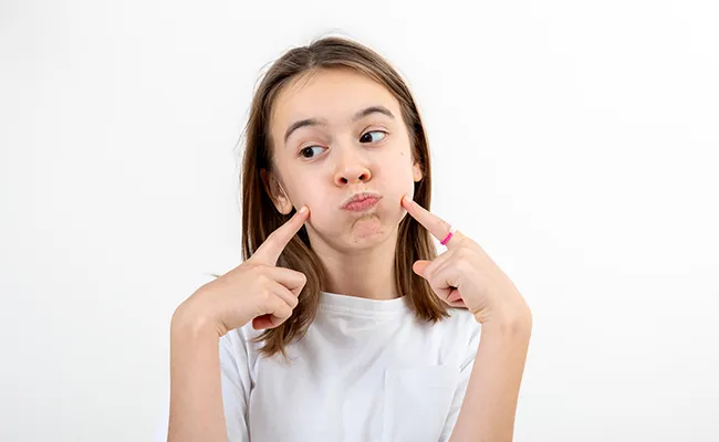 Dimple Surgery Candidate