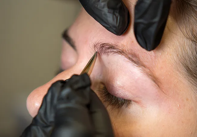 What is Eyebrow Transplant?