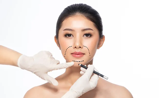 Face Liposuction Surgery