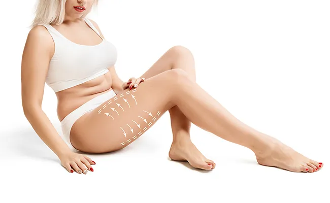 Thigh Liposuction Surgery