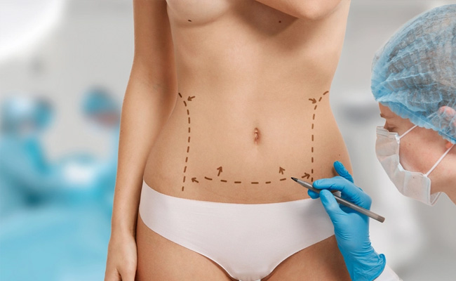 Ultrasonic Liposuction Cost