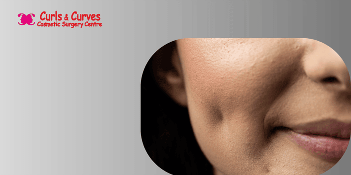 Is Dimple Creation Surgery Safe? Costs, Benefits, and What to Expect