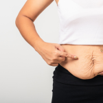 Tummy Tuck: The Definitive Guide to Abdominoplasty and Core Restoration